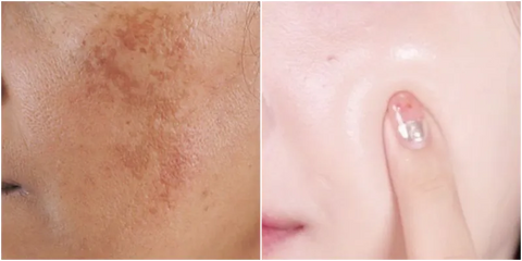 SAAM Renewal Face Cream